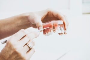 impianto dentale durata